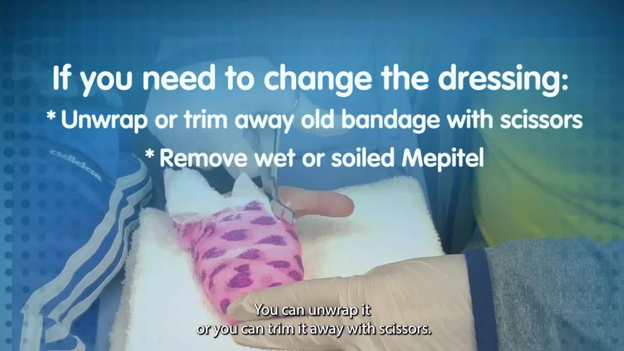 Mepitel Ag Dressing Change