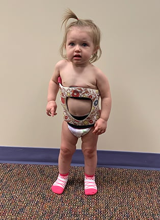 My Care Prosthetics and Orthotics on X: Boston brace for scoliosis is a  plastic body jacket used in the treatment of adolescents with idiopathic  scoliosis. The Boston brace, also referred to as