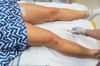 Hand holding a syringe to pull water from a patient's body.