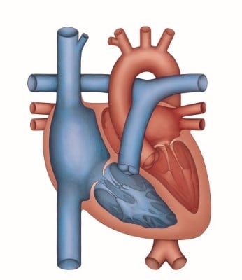 HeartWorks Global Left Ventricular Dysfunction 